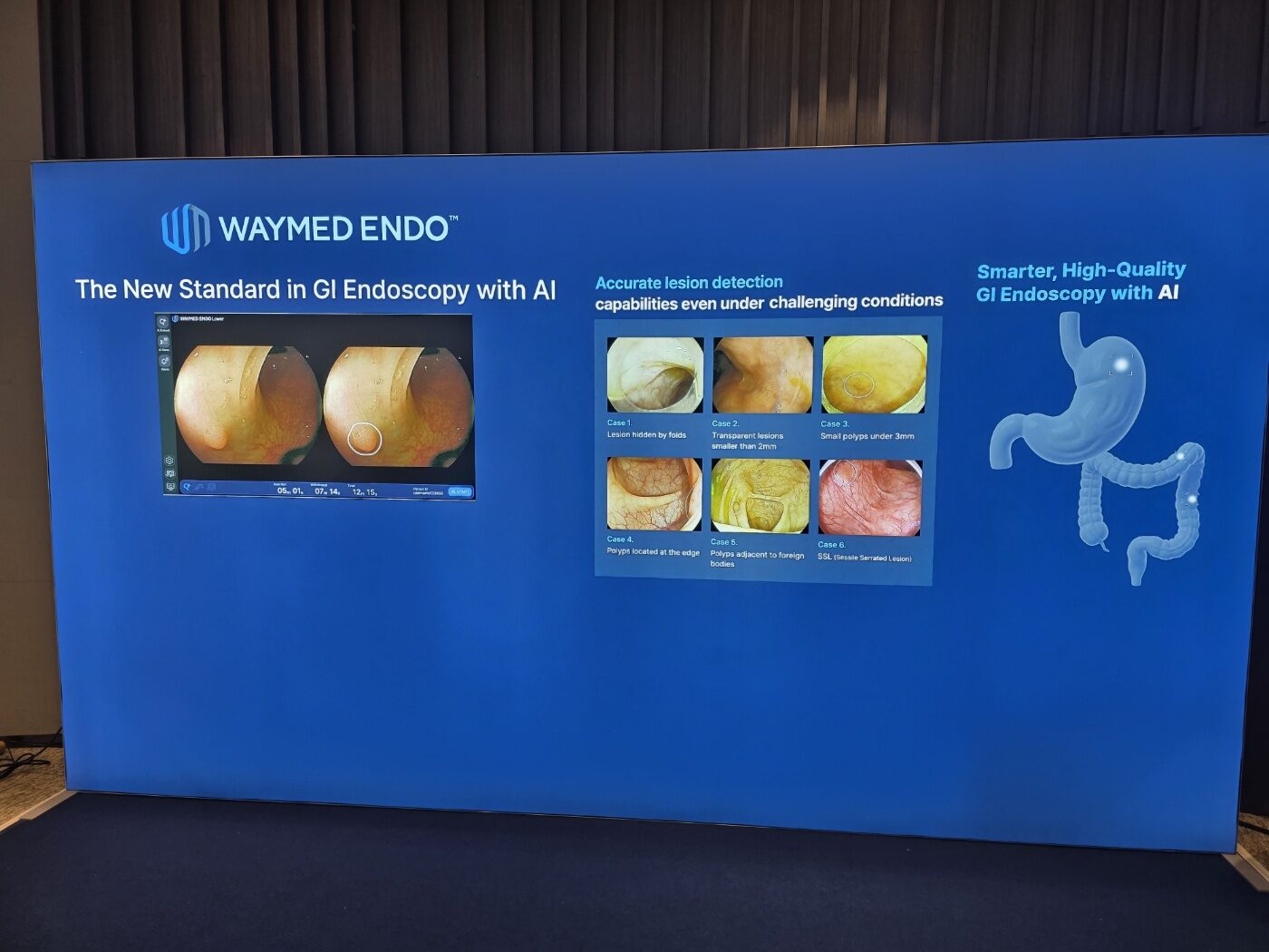 대형 LED 백월 (WAYMED ENDO)